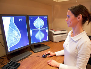 Study sugests mammograms may have created 1.3 million cases of breast cancer in US