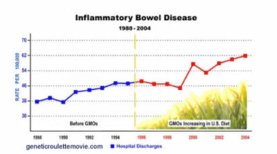 Inflammatory-Bowel-Disease-GMO