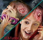 cell-phone-wireless-devices-increase-risk-of-brain-cancer